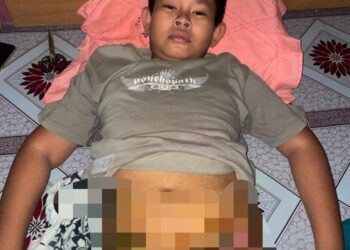 Peduli Ahkimie, Bocah dari Nunukan yang Kini Melawan Kanker