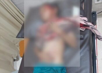 Bocah 11 Tahun Diserang Buaya di Selambai Lhoktuan Bontang, Warga Lakukan Evakuasi Cepat